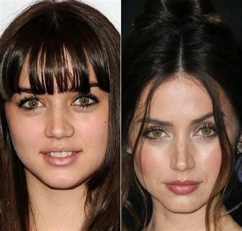 ana de armas boobs|Ana de Armas Before and After Plastic Surgery: Nose, Boob